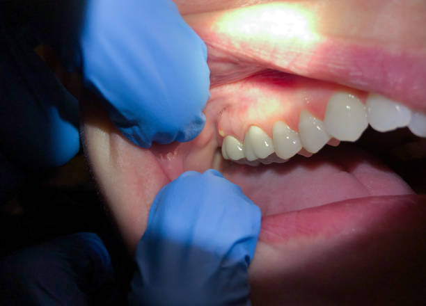 Best Pediatric Emergency Dentist in Golden Triangle, NJ