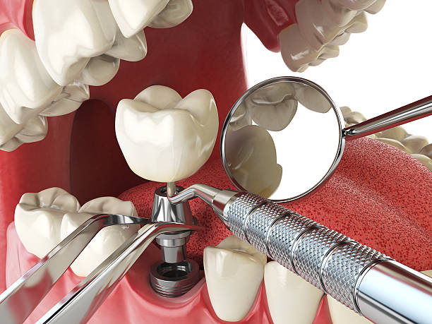 Best Emergency Dentist for Knocked-Out Tooth in Golden Triangle, NJ